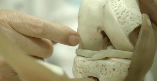 케이스템셀, 줄기세포로 세계 최초 ‘연골재생’